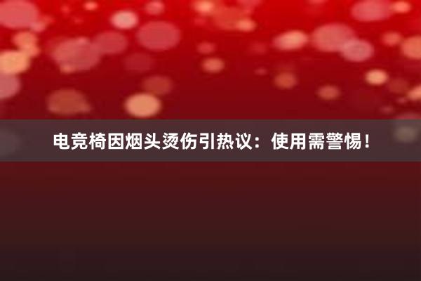 电竞椅因烟头烫伤引热议：使用需警惕！